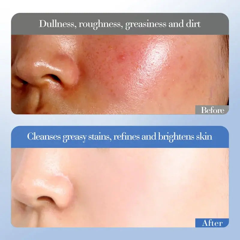 Creme Facial Hidratante Profundo – Iluminador com Niacinamida e Arroz (50g)