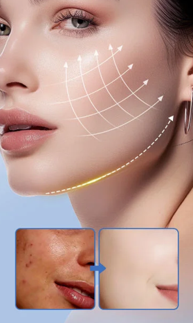 Creme Facial Hidratante Profundo – Iluminador com Niacinamida e Arroz (50g)